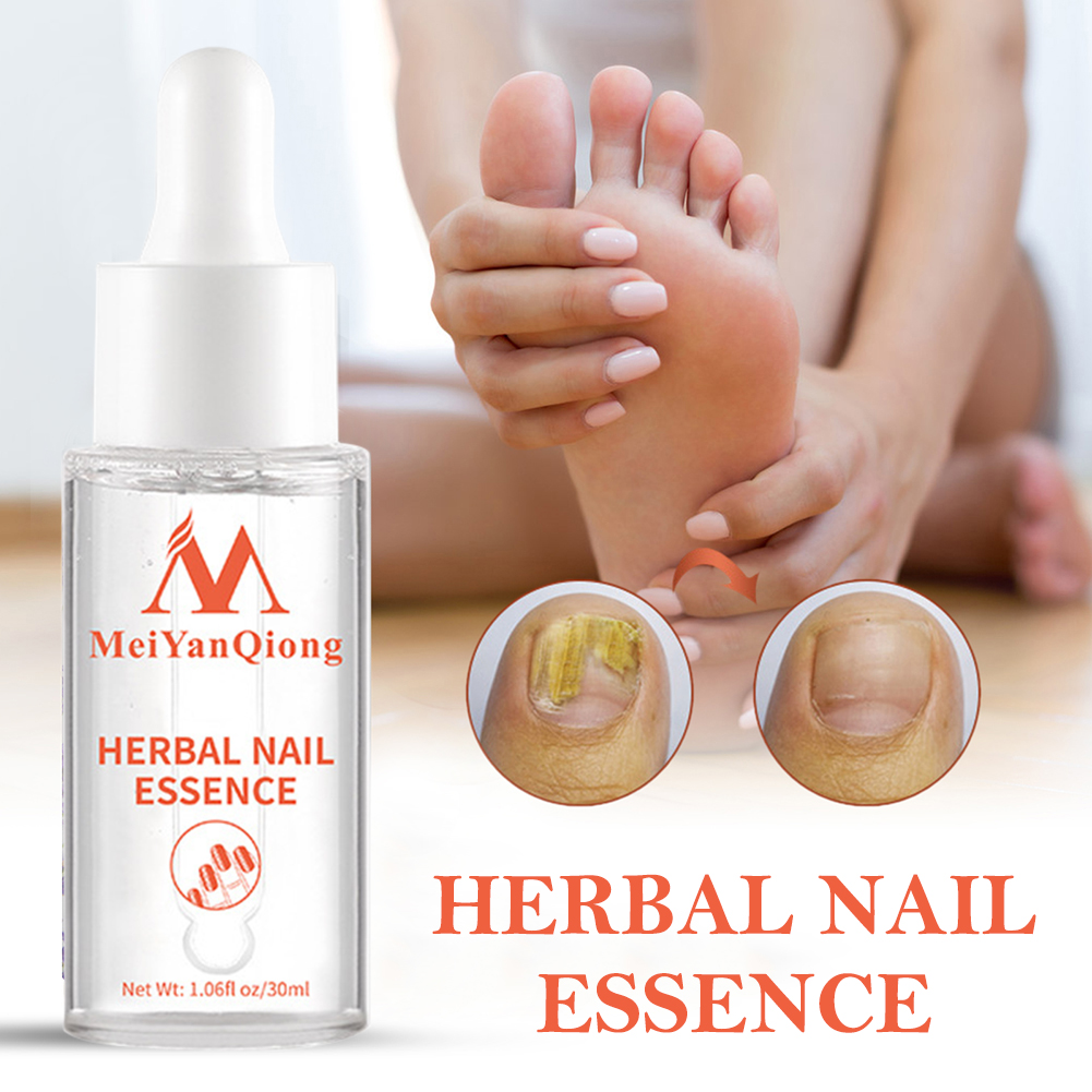 Foot Grooming Gel Anti  Nail W - огляд і ціна Mens Grooming Treatment
